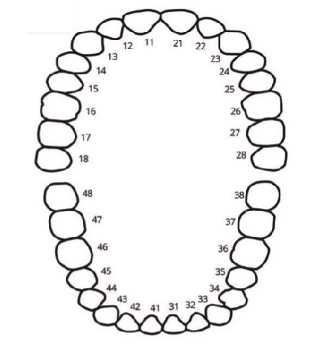 Removable Prosthetics Form - Belladent Dental Labs